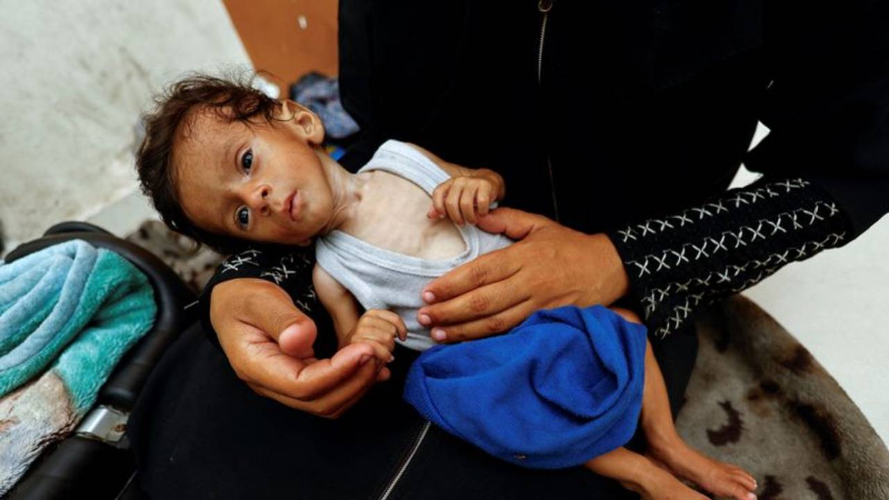Cien chicos murieron completamente desnutridos en Gaza por el bloqueo de Israel