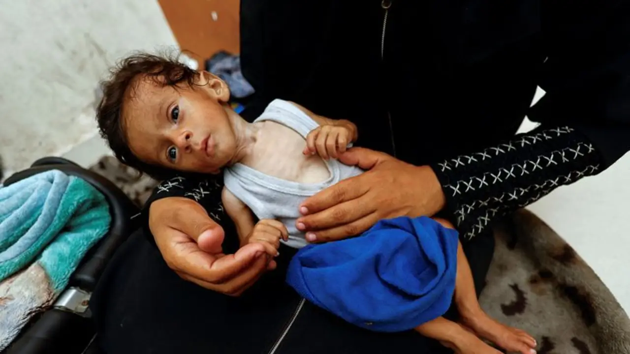 Cien chicos murieron completamente desnutridos en Gaza por el bloqueo de Israel
