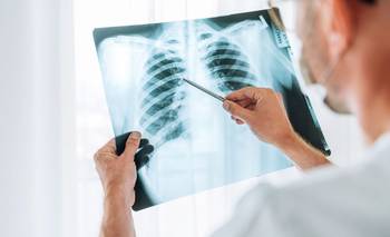 Frente al aumento global, Formosa actúa contra la tuberculosis | Salud pública
