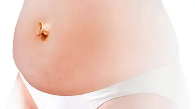 Antiinflamatorio natural: así actúa la cúrcuma en tu cuerpo Antiinflamatorio natural: así actúa la cúrcuma en tu cuerpo