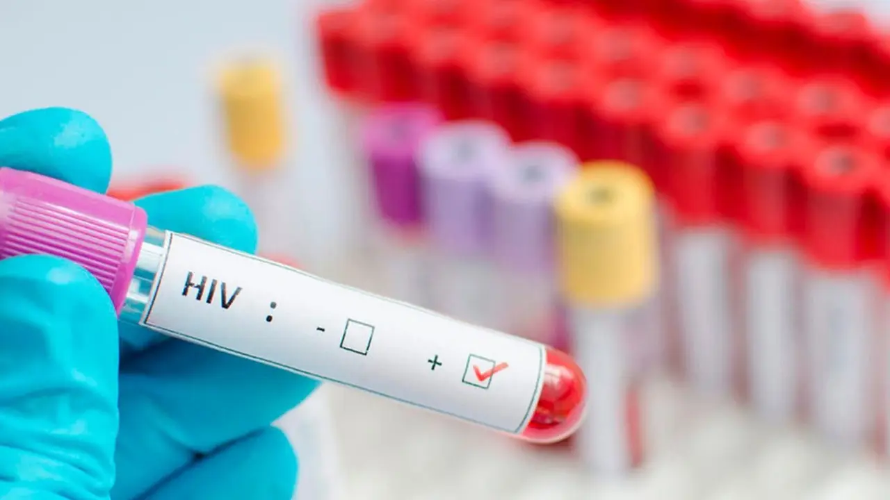 Desde Formosa desmintieron un informe de Nación sobre los contagios de HIV en todo el país: “Desactualizados” 