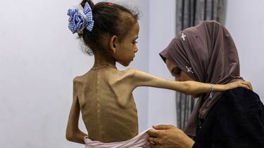 El mundo se rindió: la ONU confirmó la hambruna forzada por Israel en Gaza y todo sigue igual