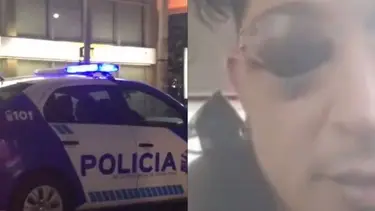 "Perdí este ojo": brutal golpiza de la Policía a un famoso cantante de la música popular