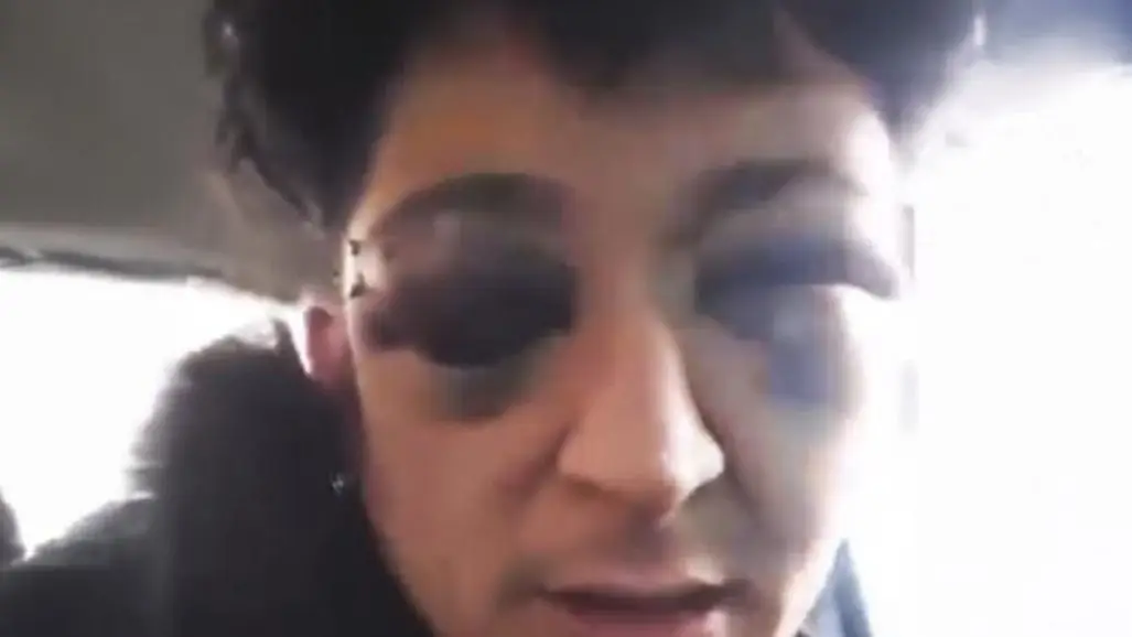 Ariel Carrizo Folklore Música Policía Golpiza Ojo