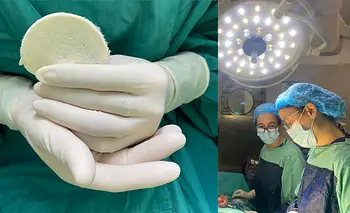 Parches de placenta: el increíble descubrimiento argentino que revoluciona la salud | Salud