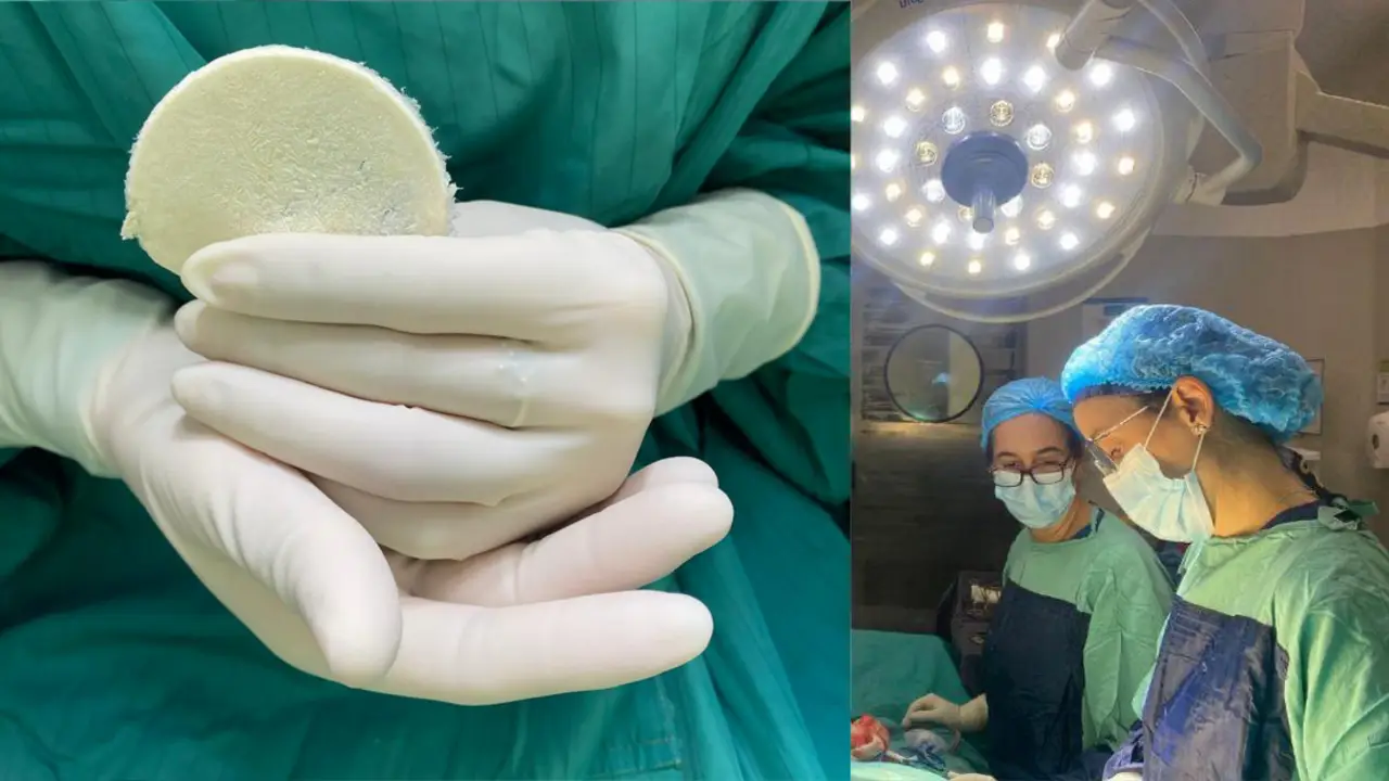 Parches de placenta: el increíble descubrimiento argentino que revoluciona la salud