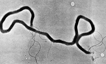La sífilis está en sus niveles más altos desde que se lleva registro | Ciencia 