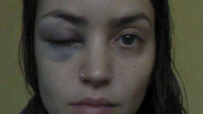 La repudiable respuesta de la Policía a una joven que denunció un intento de violación