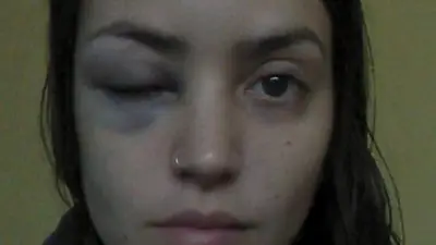La repudiable respuesta de la Policía a una joven que denunció un intento de violación La repudiable respuesta de la Policía a una joven que denunció un intento de violación
