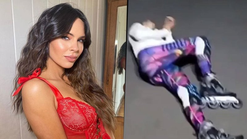 Barby Franco muestra cómo quedó tras un accidente sufrido en la calle: "Me raspé toda"