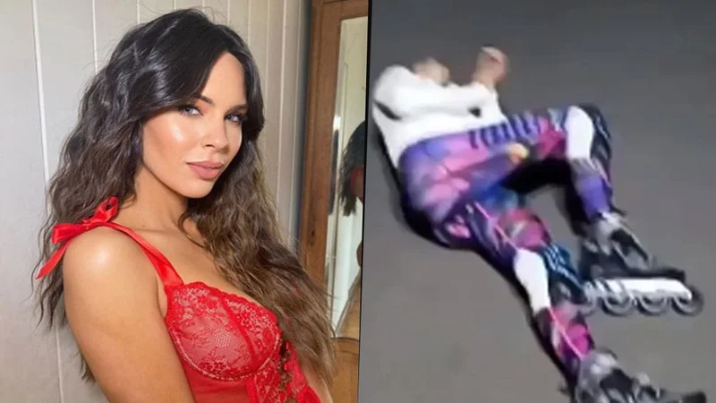 Barby Franco muestra cómo quedó tras un accidente sufrido en la calle: "Me raspé toda"