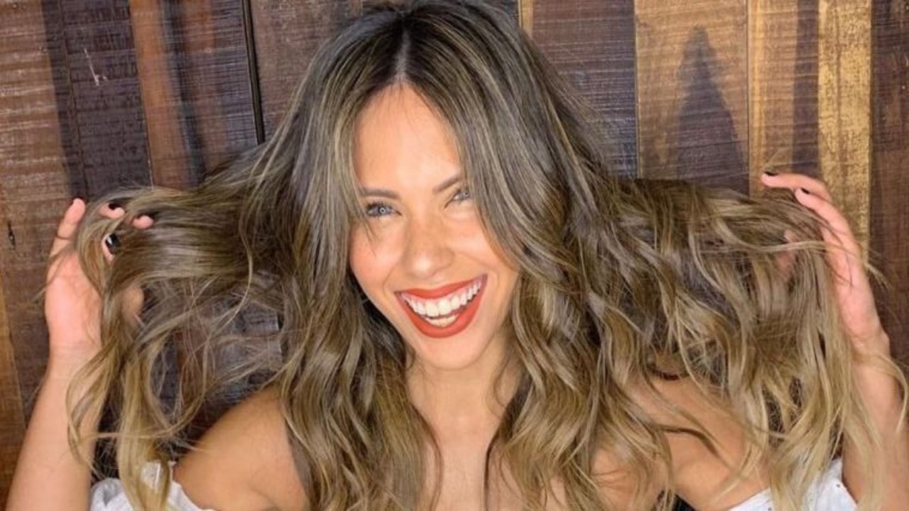 Barby Franco muestra cómo quedó tras un accidente sufrido en la calle: "Me raspé toda"