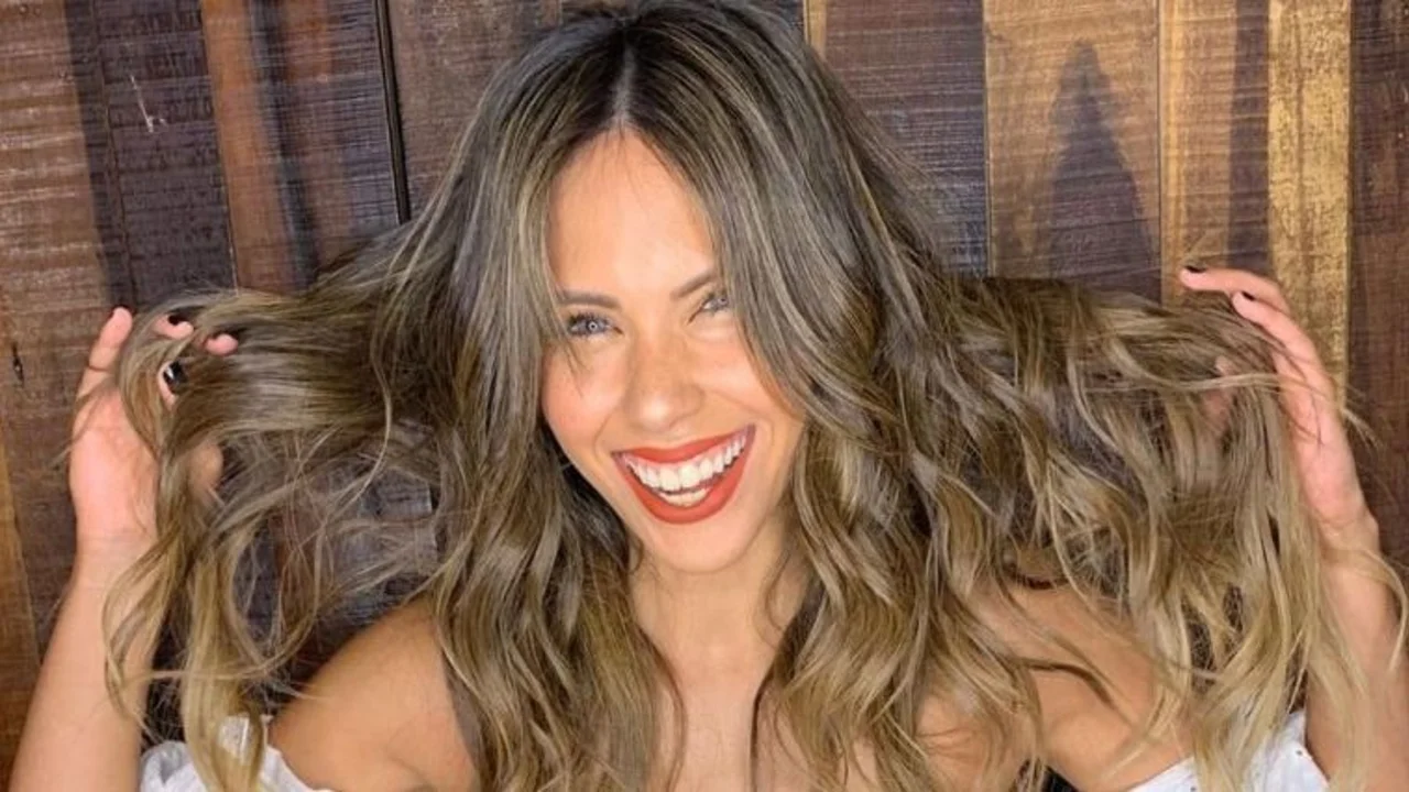 Barby Franco muestra cómo quedó tras un accidente sufrido en la calle: "Me raspé toda"