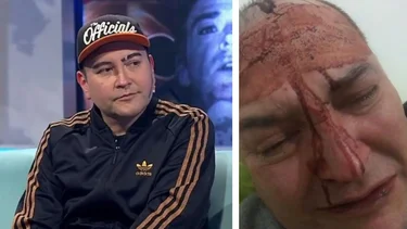Leo García apareció en televisión tras el brutal ataque homofóbico