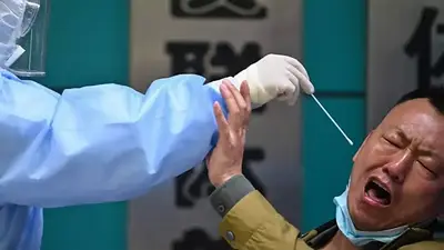Coronavirus, Japón, Síndrome del Ano inquieto, enfermedades, salud Coronavirus, Japón, Síndrome del Ano inquieto, enfermedades, salud