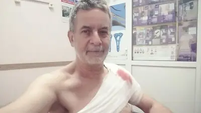 Un periodista de Telesur fue herido por un ataque ucraniano en Donetsk Un periodista de Telesur fue herido por un ataque ucraniano en Donetsk
