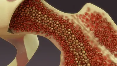 La importancia de donar médula ósea para pacientes hematológicos La importancia de donar médula ósea para pacientes hematológicos
