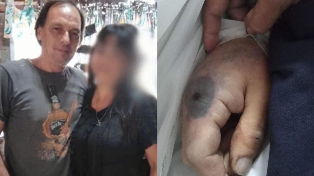 Un hombre murió tras haber sido picado por una araña en La Plata