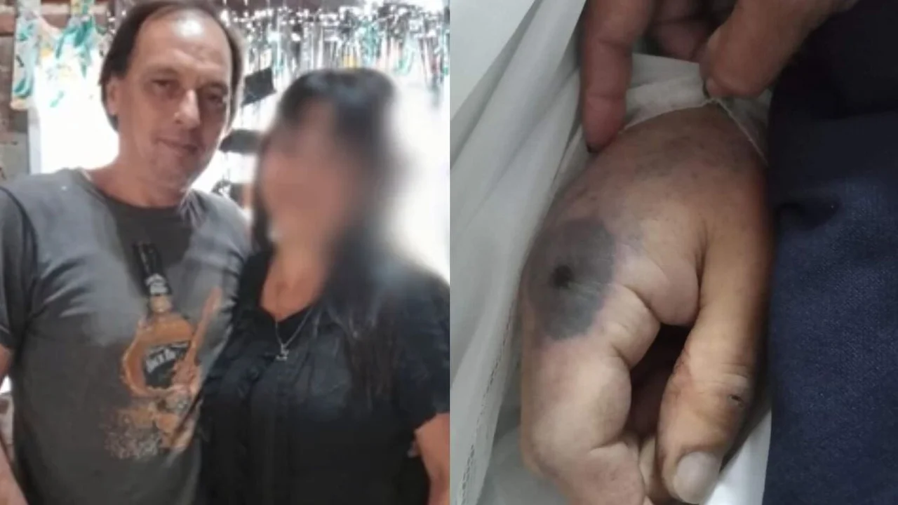 Un hombre murió tras haber sido picado por una araña en La Plata