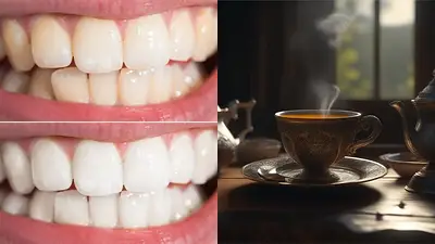 Dientes con y sin sarro y una taza. Dientes con y sin sarro y una taza.