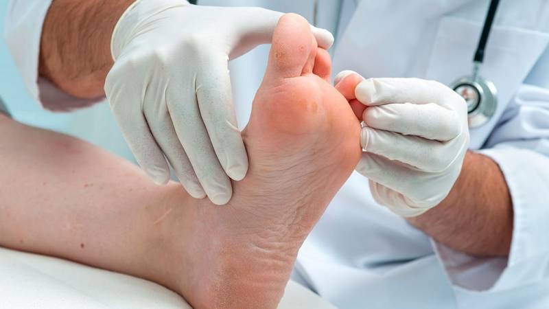 Curar hongos de los pies