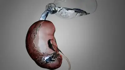 Qué pasa si no tomo agua. Se peude reemplazar el agua por gaseosa Qué pasa si no tomo agua. Se peude reemplazar el agua por gaseosa