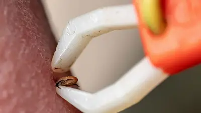 ALERTA en tu jardín: si tenés esta planta, puede haber garrapatas sin que lo sepas ALERTA en tu jardín: si tenés esta planta, puede haber garrapatas sin que lo sepas