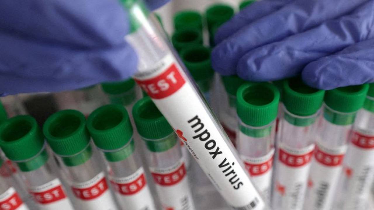 India informa del primer caso de viruela símica de la variedad clado 1b de rápida propagación