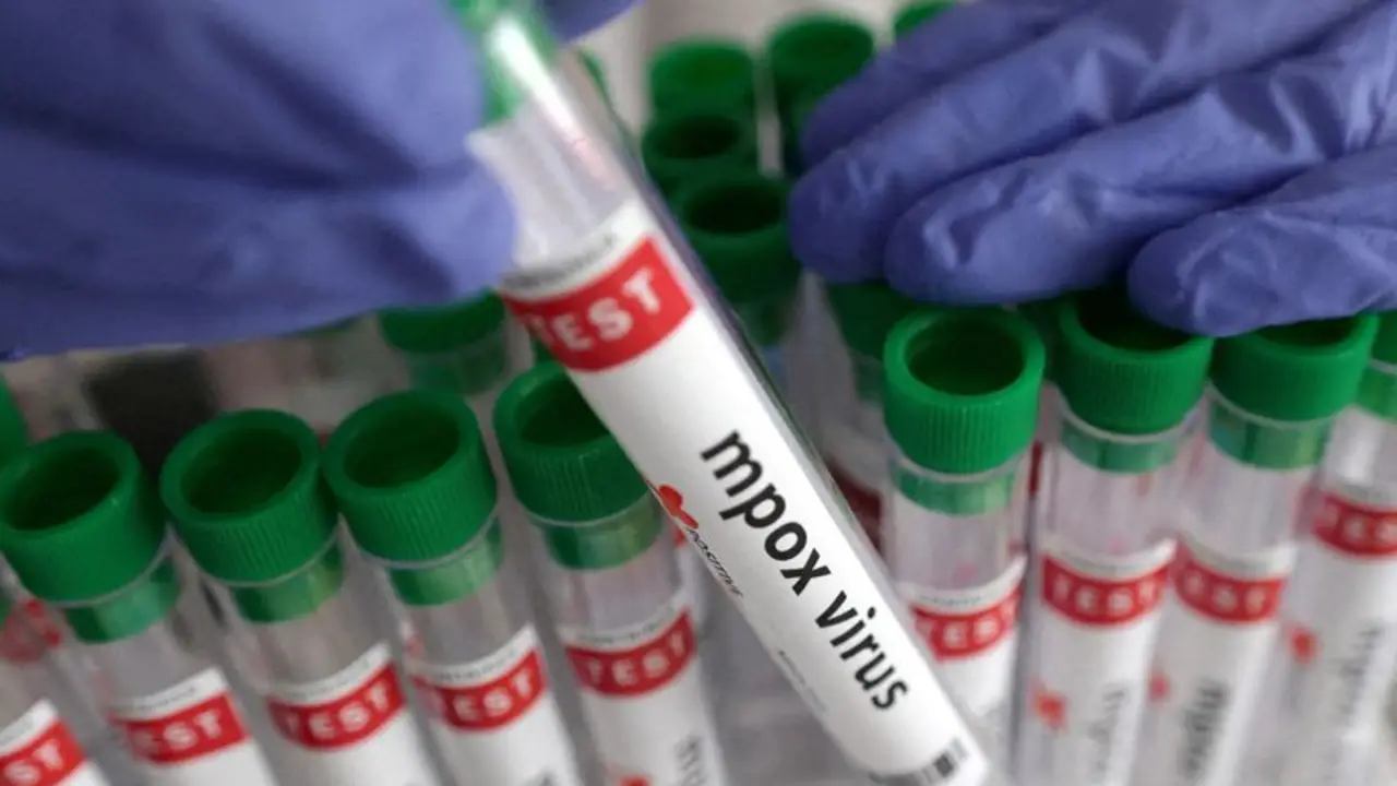 India informa del primer caso de viruela símica de la variedad clado 1b de rápida propagación