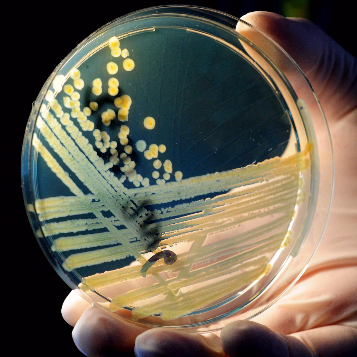 Maldi-Bot: la IA argentina que simplifica el diagnóstico bacteriano