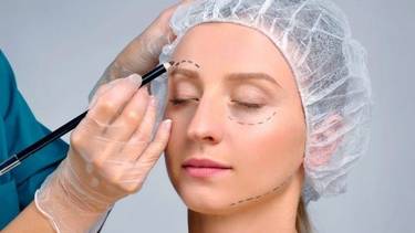 Cejaplastía: la cirugía tendencia para rejuvenecer el rostro
