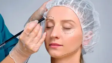 Cejaplastía: la cirugía tendencia para rejuvenecer el rostro