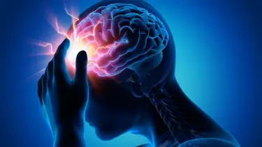 Migraña en Argentina: por qué automedicarte puede empeorar tu dolor de cabeza