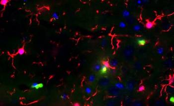 Un medicamento para la diabetes podría proteger contra el Alzheimer | Salud