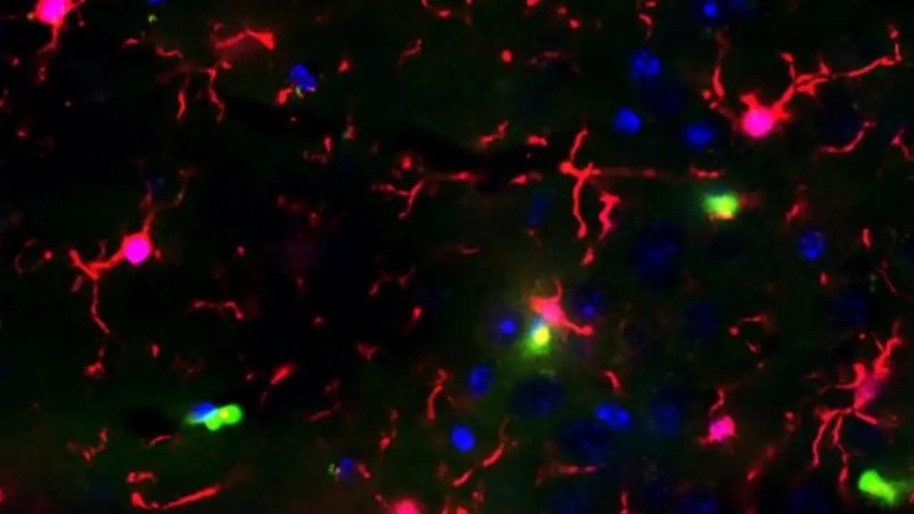 Descubren que un medicamento para la diabetes podría proteger contra el Alzheimer