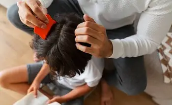 Colita de pelo anti-piojos: el invento argentino que es tendencia | Piojos