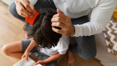 Cómo es la colita de pelo anti-piojos. Cómo es la colita de pelo anti-piojos.