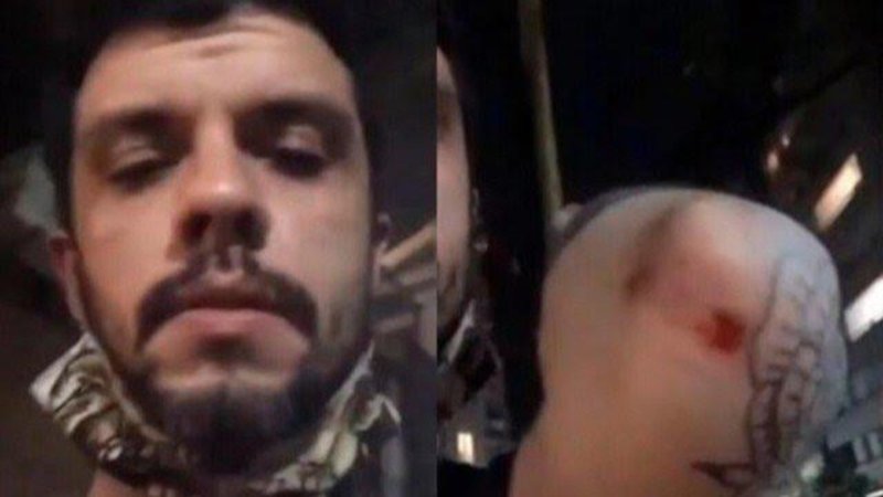 Ataque homofóbico en Palermo: golpearon a una pareja gay que se estaba besando