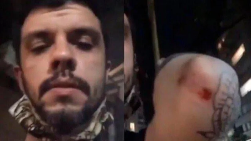 Ataque homofóbico en Palermo: golpearon a una pareja gay que se estaba besando