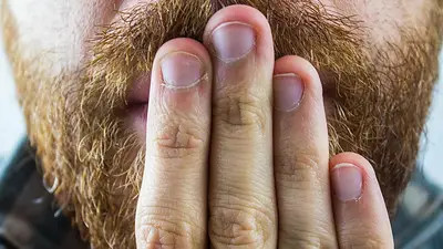 Cómo quitar el hipo: consejos, trucos y tips Cómo quitar el hipo: consejos, trucos y tips