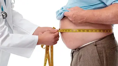 Tipo de obesidad Tipo de obesidad
