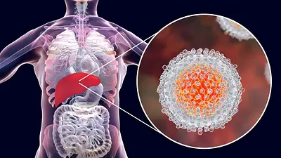 Realizan campaña de concientización y detección de hepatitis C en 70 hospitales del país Realizan campaña de concientización y detección de hepatitis C en 70 hospitales del país