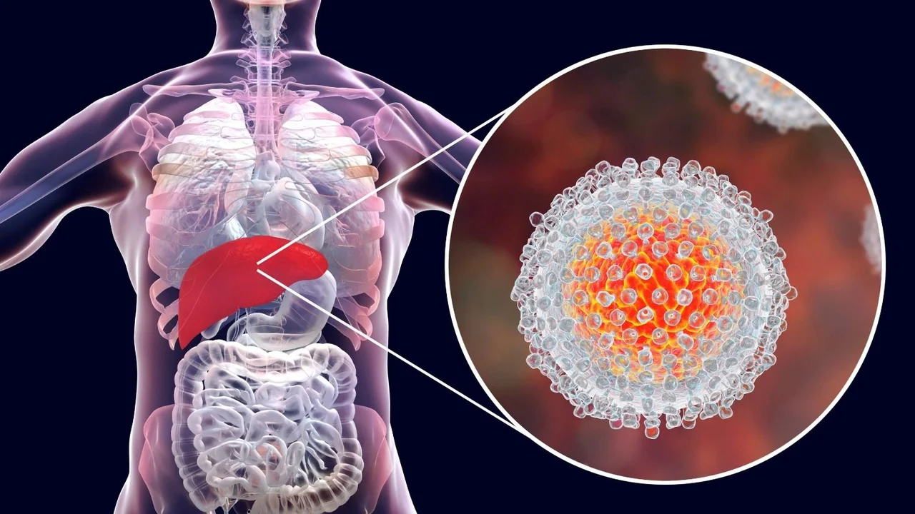 Realizan campaña de concientización y detección de hepatitis C en 70 hospitales del país