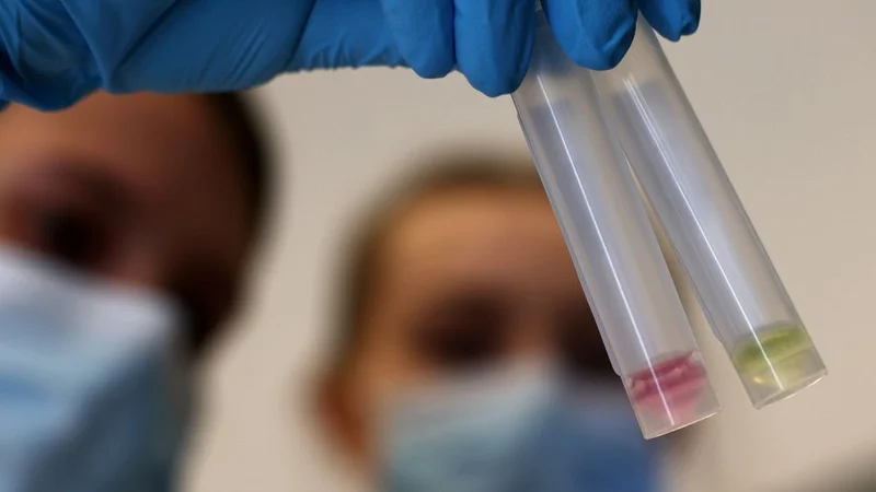 Coronavirus: cómo funciona NEOKIT PLUS, el test desarrollado por científicos argentinos