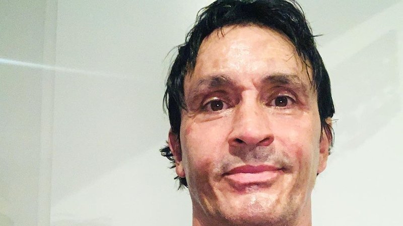 "En un segundo estaba prendido fuego": Sebastián Estevanez rompió el silencio tras su trágico accidente
