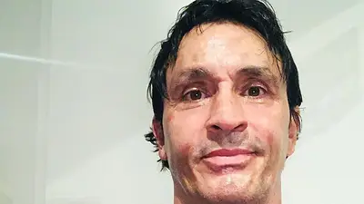 "En un segundo estaba prendido fuego": Sebastián Estevanez rompió el silencio tras su trágico accidente "En un segundo estaba prendido fuego": Sebastián Estevanez rompió el silencio tras su trágico accidente