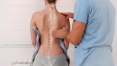 Enfermedades, salud, escoliosis Enfermedades, salud, escoliosis