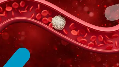 Anemia. Anemia.