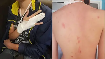 El hijo de concejala macrista Anita Martínez fracturó a compañero de colegio El hijo de concejala macrista Anita Martínez fracturó a compañero de colegio