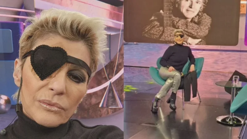 Carolina Papaleo apareció con un parche en el ojo y generó gran preocupación.